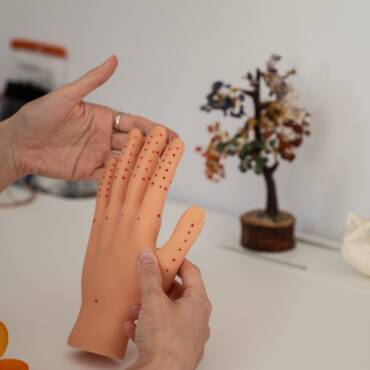 Иглорефлексотерапия